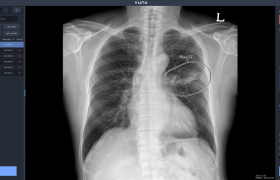 img-fluid rounded-start